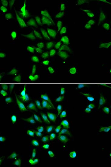 Immunocytochemistry/ Immunofluorescence: SUG1 Antibody [NBP3-35540] - Immunofluorescence analysis of MCF-7 cells using SUG1 Rabbit pAb. Secondary antibody: Cy3-conjugated Goat anti-Rabbit IgG (H+L) at 1:500 dilution. Blue: DAPI for nuclear staining.