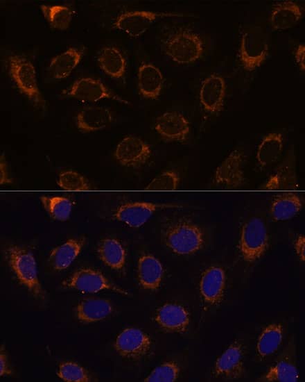 Immunocytochemistry/ Immunofluorescence: TCIRG1 Antibody [NBP3-35541] - Immunofluorescence analysis of U-2 OS cells using TCIRG1 Rabbit pAb at dilution of 1:100 (40x lens). Secondary antibody: Cy3-conjugated Goat anti-Rabbit IgG (H+L) at 1:500 dilution. Blue: DAPI for nuclear staining.