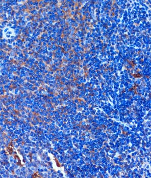 Immunohistochemistry: TCIRG1 Antibody [NBP3-35541] - Immunohistochemistry analysis of paraffin-embedded Mouse spleen using TCIRG1 Rabbit pAb at dilution of 1:100 (40x lens). Microwave antigen retrieval performed with 0.01M PBS Buffer (pH 7.2) prior to IHC staining.