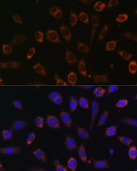 Immunocytochemistry/ Immunofluorescence: TCIRG1 Antibody [NBP3-35541] - Immunofluorescence analysis of L929 cells using TCIRG1 Rabbit pAb at dilution of 1:100 (40x lens). Secondary antibody: Cy3-conjugated Goat anti-Rabbit IgG (H+L) at 1:500 dilution. Blue: DAPI for nuclear staining.