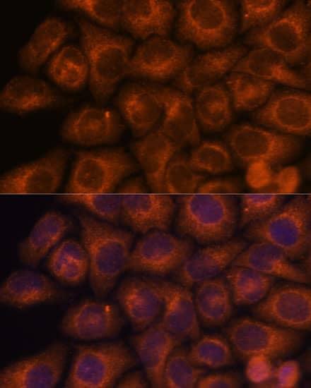 Immunocytochemistry/ Immunofluorescence: SEC23IP Antibody [NBP3-35544] - Immunofluorescence analysis of HeLa cells using SEC23IP Rabbit pAb at dilution of 1:100. Secondary antibody: Cy3-conjugated Goat anti-Rabbit IgG (H+L) at 1:500 dilution. Blue: DAPI for nuclear staining.