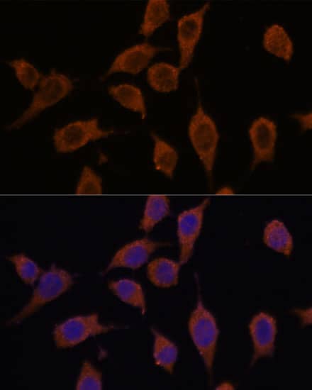 Immunocytochemistry/ Immunofluorescence: SEC23IP Antibody [NBP3-35544] - Immunofluorescence analysis of L929 cells using SEC23IP Rabbit pAb at dilution of 1:100. Secondary antibody: Cy3-conjugated Goat anti-Rabbit IgG (H+L) at 1:500 dilution. Blue: DAPI for nuclear staining.