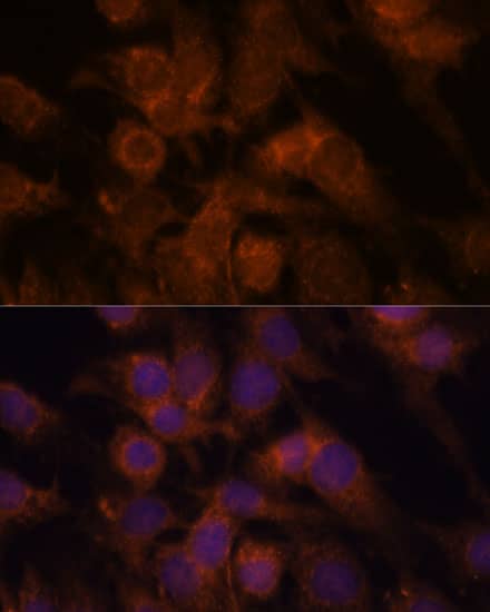 Immunocytochemistry/ Immunofluorescence: SEC23IP Antibody [NBP3-35544] - Immunofluorescence analysis of C6 cells using SEC23IP Rabbit pAb at dilution of 1:100. Secondary antibody: Cy3-conjugated Goat anti-Rabbit IgG (H+L) at 1:500 dilution. Blue: DAPI for nuclear staining.