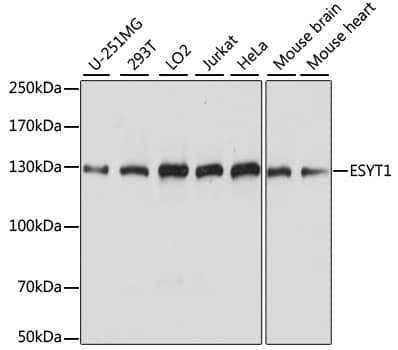 Western Blot FAM62A Antibody