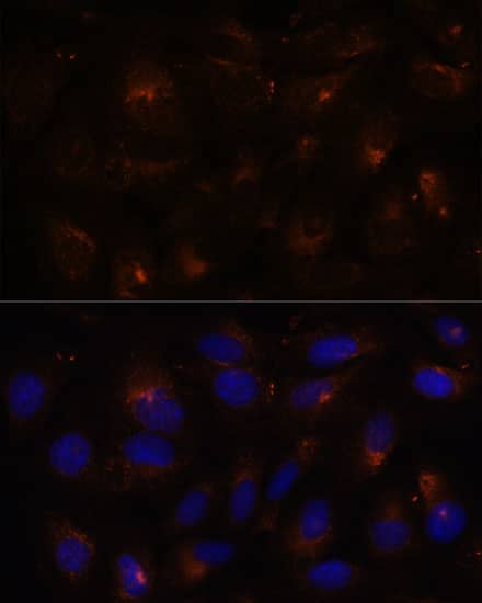 Immunocytochemistry/ Immunofluorescence: FAM62A Antibody [NBP3-35546] - Immunofluorescence analysis of U-2 OS cells using FAM62A Rabbit pAb at dilution of 1:100. Secondary antibody: Cy3-conjugated Goat anti-Rabbit IgG (H+L) at 1:500 dilution. Blue: DAPI for nuclear staining.