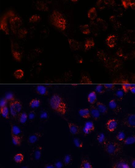 Immunocytochemistry/ Immunofluorescence: CGI-16 Antibody [NBP3-35548] - Immunofluorescence analysis of A431 cells using CGI-16 Rabbit pAb at dilution of 1:100. Secondary antibody: Cy3-conjugated Goat anti-Rabbit IgG (H+L) at 1:500 dilution. Blue: DAPI for nuclear staining.