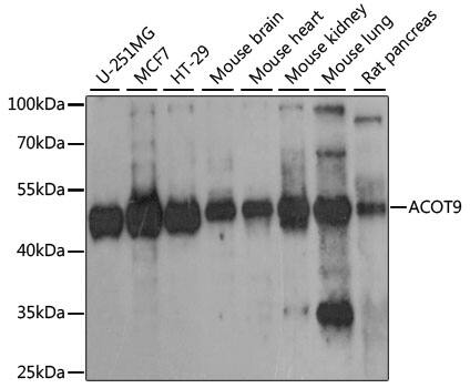 Western Blot: CGI-16 Antibody [NBP3-35548] - Western blot analysis of various lysates using CGI-16 Rabbit pAb at 1:1000 dilution.Secondary antibody: HRP-conjugated Goat anti-Rabbit IgG (H+L) at 1:10000 dilution.Lysates/proteins: 25ug per lane.Blocking buffer: 3% nonfat dry milk in TBST.Detection: ECL Basic Kit.Exposure time: 30s.