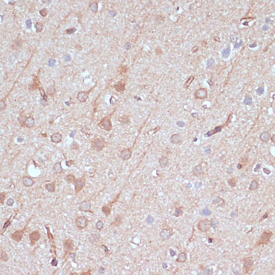 Immunohistochemistry: AK5 Antibody [NBP3-35549] - Immunohistochemistry analysis of paraffin-embedded Rat brain using AK5 Rabbit pAb at dilution of 1:100 (40x lens). Microwave antigen retrieval performed with 0.01M PBS Buffer (pH 7.2) prior to IHC staining.