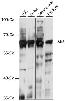 Western Blot: AK5 Antibody [NBP3-35549] - Western blot analysis of various lysates using AK5 Rabbit pAb at 1:1000 dilution.Secondary antibody: HRP-conjugated Goat anti-Rabbit IgG (H+L) at 1:10000 dilution.Lysates/proteins: 25ug per lane.Blocking buffer: 3% nonfat dry milk in TBST.Detection: ECL Basic Kit.Exposure time: 10s.