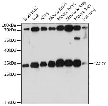 Western Blot: CCDC44 Antibody [NBP3-35553] - Western blot analysis of various lysates using CCDC44 Rabbit pAb at 1:1000 dilution.Secondary antibody: HRP-conjugated Goat anti-Rabbit IgG (H+L) at 1:10000 dilution.Lysates/proteins: 25ug per lane.Blocking buffer: 3% nonfat dry milk in TBST.Detection: ECL Basic Kit.Exposure time: 90s.