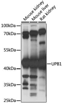 Western Blot: beta ureidopropionase Antibody [NBP3-35555] - Western blot analysis of various lysates using beta ureidopropionase Rabbit pAb at 1:1000 dilution.Secondary antibody: HRP-conjugated Goat anti-Rabbit IgG (H+L) at 1:10000 dilution.Lysates/proteins: 25ug per lane.Blocking buffer: 3% nonfat dry milk in TBST.Detection: ECL Basic Kit.Exposure time: 30s.