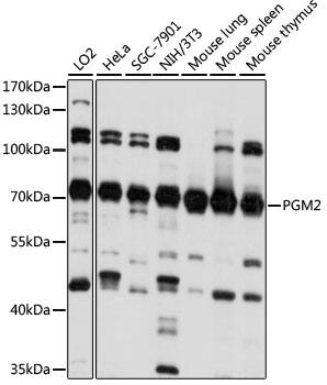 Western Blot: PGM2 Antibody [NBP3-35558] - Western blot analysis of various lysates using PGM2 Rabbit pAb at 1:1000 dilution.Secondary antibody: HRP-conjugated Goat anti-Rabbit IgG (H+L) at 1:10000 dilution.Lysates/proteins: 25ug per lane.Blocking buffer: 3% nonfat dry milk in TBST.Detection: ECL Basic Kit.Exposure time: 10s.