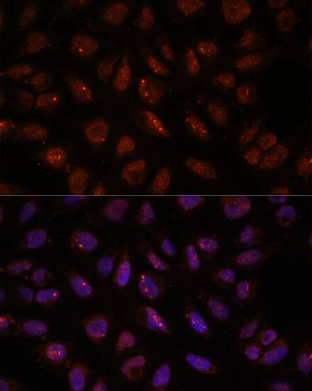 Immunocytochemistry/ Immunofluorescence: DDX24 Antibody [NBP3-35561] - Immunofluorescence analysis of U-2 OS cells using DDX24 Rabbit pAb at dilution of 1:100. Secondary antibody: Cy3-conjugated Goat anti-Rabbit IgG (H+L) at 1:500 dilution. Blue: DAPI for nuclear staining.