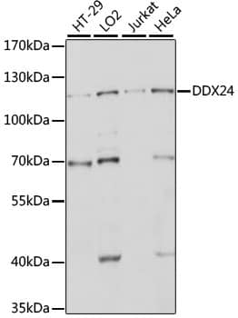 Western Blot: DDX24 Antibody [NBP3-35561] - Western blot analysis of various lysates using DDX24 Rabbit pAb at 1:1000 dilution.Secondary antibody: HRP-conjugated Goat anti-Rabbit IgG (H+L) at 1:10000 dilution.Lysates/proteins: 25ug per lane.Blocking buffer: 3% nonfat dry milk in TBST.Detection: ECL Basic Kit.Exposure time: 10s.