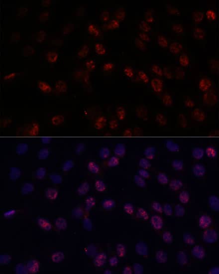 Immunocytochemistry/ Immunofluorescence: DDX24 Antibody [NBP3-35561] - Immunofluorescence analysis of C6 cells using DDX24 Rabbit pAb at dilution of 1:100. Secondary antibody: Cy3-conjugated Goat anti-Rabbit IgG (H+L) at 1:500 dilution. Blue: DAPI for nuclear staining.