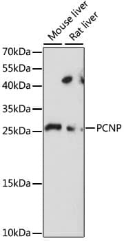 Western Blot: PCNP Antibody [NBP3-35562] - Western blot analysis of various lysates using PCNP Rabbit pAb at 1:1000 dilution.Secondary antibody: HRP-conjugated Goat anti-Rabbit IgG (H+L) at 1:10000 dilution.Lysates/proteins: 25ug per lane.Blocking buffer: 3% nonfat dry milk in TBST.Detection: ECL Basic Kit.Exposure time: 30s.