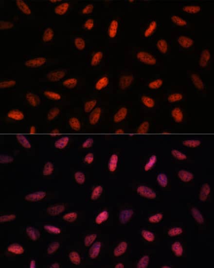 Immunocytochemistry/ Immunofluorescence: ARID1B Antibody [NBP3-35563] - Immunofluorescence analysis of U-2 OS cells using ARID1B Rabbit pAb at dilution of 1:100. Secondary antibody: Cy3-conjugated Goat anti-Rabbit IgG (H+L) at 1:500 dilution. Blue: DAPI for nuclear staining.