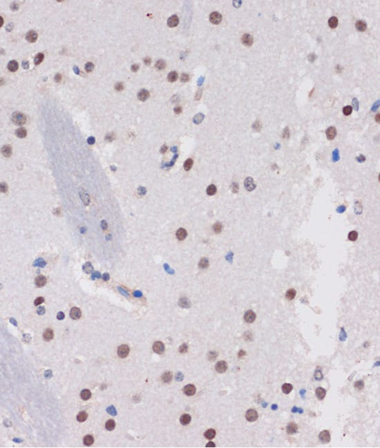 Immunohistochemistry: ARID1B Antibody [NBP3-35563] - Immunohistochemistry analysis of paraffin-embedded Mouse brain using ARID1B Rabbit pAb at dilution of 1:100 (40x lens). Microwave antigen retrieval performed with 0.01M PBS Buffer (pH 7.2) prior to IHC staining.