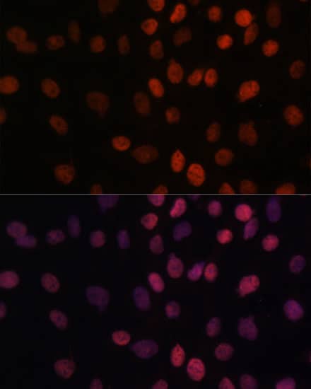 Immunocytochemistry/ Immunofluorescence: ARID1B Antibody [NBP3-35563] - Immunofluorescence analysis of C6 cells using ARID1B Rabbit pAb at dilution of 1:100. Secondary antibody: Cy3-conjugated Goat anti-Rabbit IgG (H+L) at 1:500 dilution. Blue: DAPI for nuclear staining.