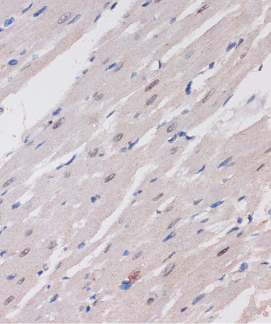 Immunohistochemistry: ARID1B Antibody [NBP3-35563] - Immunohistochemistry analysis of paraffin-embedded Rat heart using ARID1B Rabbit pAb at dilution of 1:100 (40x lens). Microwave antigen retrieval performed with 0.01M PBS Buffer (pH 7.2) prior to IHC staining.