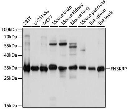 Western Blot: Fructosamine-3-kinase-related Antibody [NBP3-35566] - Western blot analysis of various lysates using Fructosamine-3-kinase-related Rabbit pAb at 1:1000 dilution.Secondary antibody: HRP-conjugated Goat anti-Rabbit IgG (H+L) at 1:10000 dilution.Lysates/proteins: 25ug per lane.Blocking buffer: 3% nonfat dry milk in TBST.Detection: ECL Basic Kit.Exposure time: 5s.