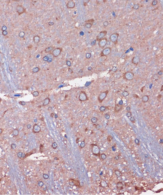 Immunohistochemistry WDR61 Antibody