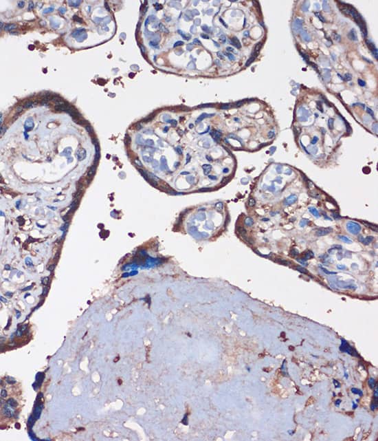 Immunohistochemistry WDR61 Antibody