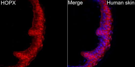 Immunocytochemistry/ Immunofluorescence: HOP Antibody [NBP3-35571] - Immunofluorescence analysis of paraffin-embedded Human skin using HOP Rabbit pAbat a dilution of 1:200 (40x lens). Secondary antibody:Cy3 Goat Anti-Rabbit IgG (H+L)at 1:500 dilution. Blue: DAPI for nuclear staining.Perform high pressure antigen retrieval with 0.01 M citrate buffer (pH 6.0) prior to IF staining.