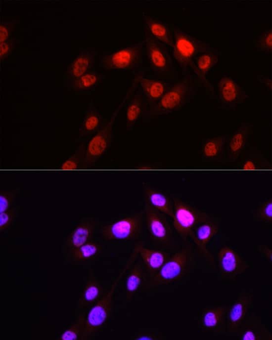 Immunocytochemistry/ Immunofluorescence: HOP Antibody [NBP3-35571] - Immunofluorescence analysis of paraffin-embedded Human skin using HOP Rabbit pAb at a dilution of 1:200 (40x lens). Secondary antibody:Cy3 Goat Anti-Rabbit IgG (H+L) at 1:500 dilution. Blue: DAPI for nuclear staining.Perform high pressure antigen retrieval with 0.01 M citrate buffer (pH 6.0) prior to IF staining.