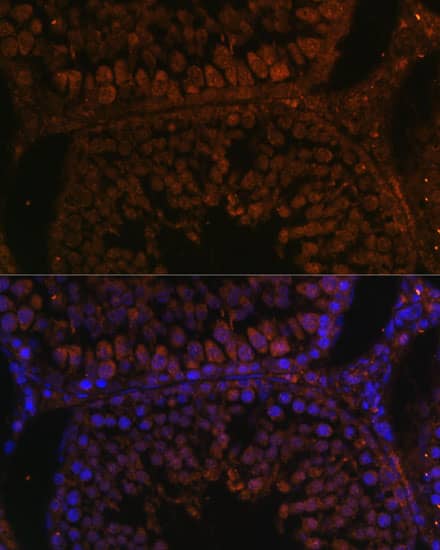 Immunocytochemistry/ Immunofluorescence: TPD52L3/D55 Antibody [NBP3-35572] - Immunofluorescence analysis of paraffin-embedded rat testis using TPD52L3/D55 Rabbit pAb at dilution of 1:100. Secondary antibody: Cy3-conjugated Goat anti-Rabbit IgG (H+L) at 1:500 dilution. Blue: DAPI for nuclear staining.