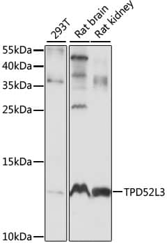 Western Blot: TPD52L3/D55 Antibody [NBP3-35572] - Western blot analysis of various lysates using TPD52L3/D55 Rabbit pAb at 1:1000 dilution.Secondary antibody: HRP-conjugated Goat anti-Rabbit IgG (H+L) at 1:10000 dilution.Lysates/proteins: 25ug per lane.Blocking buffer: 3% nonfat dry milk in TBST.Detection: ECL Basic Kit.Exposure time: 10S.