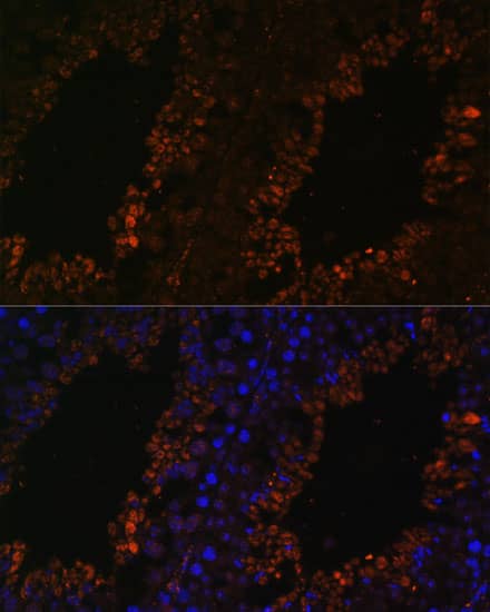 Immunocytochemistry/ Immunofluorescence: TPD52L3/D55 Antibody [NBP3-35572] - Immunofluorescence analysis of paraffin-embedded mouse testis using TPD52L3/D55 Rabbit pAb at dilution of 1:100. Secondary antibody: Cy3-conjugated Goat anti-Rabbit IgG (H+L) at 1:500 dilution. Blue: DAPI for nuclear staining.