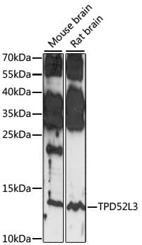 Western Blot: TPD52L3/D55 Antibody [NBP3-35573] - Western blot analysis of various lysates using TPD52L3/D55 Rabbit pAb at 1:1000 dilution.Secondary antibody: HRP-conjugated Goat anti-Rabbit IgG (H+L) at 1:10000 dilution.Lysates/proteins: 25ug per lane.Blocking buffer: 3% nonfat dry milk in TBST.Detection: ECL Basic Kit.Exposure time: 30S.