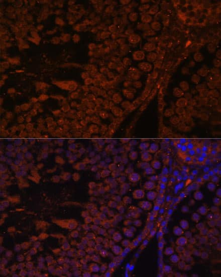 Immunocytochemistry/ Immunofluorescence: TPD52L3/D55 Antibody [NBP3-35573] - Immunofluorescence analysis of paraffin-embedded rat testis using TPD52L3/D55 Rabbit pAb at dilution of 1:100. Secondary antibody: Cy3-conjugated Goat anti-Rabbit IgG (H+L) at 1:500 dilution. Blue: DAPI for nuclear staining.