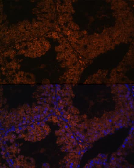 Immunocytochemistry/ Immunofluorescence: TPD52L3/D55 Antibody [NBP3-35573] - Immunofluorescence analysis of paraffin-embedded mouse testis using TPD52L3/D55 Rabbit pAb at dilution of 1:100. Secondary antibody: Cy3-conjugated Goat anti-Rabbit IgG (H+L) at 1:500 dilution. Blue: DAPI for nuclear staining.