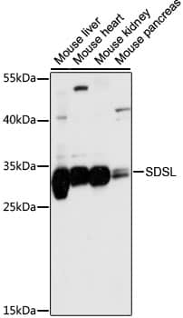 Western Blot: SDSL Antibody [NBP3-35574] - Western blot analysis of various lysates using SDSL Rabbit pAb at 1:1000 dilution.Secondary antibody: HRP-conjugated Goat anti-Rabbit IgG (H+L) at 1:10000 dilution.Lysates/proteins: 25ug per lane.Blocking buffer: 3% nonfat dry milk in TBST.Detection: ECL Basic Kit.Exposure time: 5s.