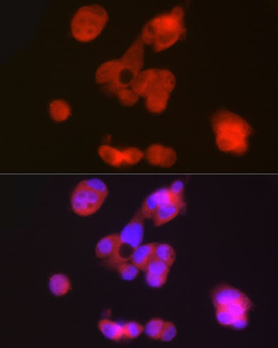 Immunocytochemistry/ Immunofluorescence: Phenylalanine Hydroxylase Antibody [NBP3-35577] - Immunofluorescence analysis of HepG2 cells using Phenylalanine Hydroxylase Rabbit pAb at dilution of 1:50 (40x lens). Secondary antibody: Cy3-conjugated Goat anti-Rabbit IgG (H+L) at 1:500 dilution. Blue: DAPI for nuclear staining.