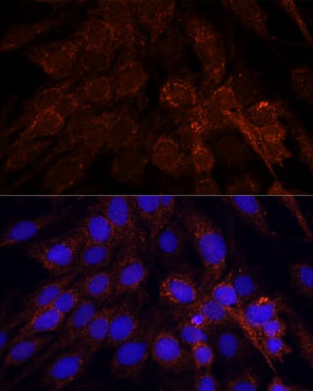 Immunocytochemistry/ Immunofluorescence: mtRNA polymerase Antibody [NBP3-35578] - Immunofluorescence analysis of C6 cells using mtRNA polymerase Rabbit pAb at dilution of 1:100. Secondary antibody: Cy3-conjugated Goat anti-Rabbit IgG (H+L) at 1:500 dilution. Blue: DAPI for nuclear staining.