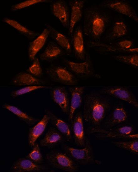 Immunocytochemistry/ Immunofluorescence: mtRNA polymerase Antibody [NBP3-35578] - Immunofluorescence analysis of U-2 OS cells using mtRNA polymerase Rabbit pAb at dilution of 1:100. Secondary antibody: Cy3-conjugated Goat anti-Rabbit IgG (H+L) at 1:500 dilution. Blue: DAPI for nuclear staining.