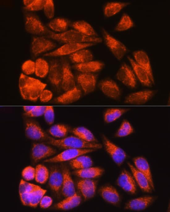 Immunocytochemistry/ Immunofluorescence: ODF2 Antibody [NBP3-35580] - Immunofluorescence analysis of HeLa cells using ODF2 Rabbit pAb at dilution of 1:100 (40x lens). Secondary antibody: Cy3-conjugated Goat anti-Rabbit IgG (H+L) at 1:500 dilution. Blue: DAPI for nuclear staining.