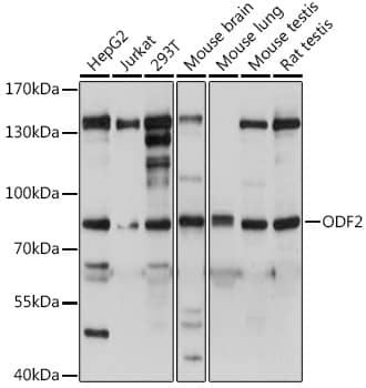 Western Blot: ODF2 Antibody [NBP3-35580] - Western blot analysis of various lysates using ODF2 Rabbit pAb at  dilution.Secondary antibody: HRP-conjugated Goat anti-Rabbit IgG (H+L) at 1:10000 dilution.Lysates/proteins: 25ug per lane.Blocking buffer: 3% nonfat dry milk in TBST.Detection: ECL Basic Kit.Exposure time: 3s.