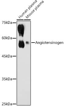 Western Blot: Serpin A8/Angiotensinogen Antibody [NBP3-35581] - Western blot analysis of various lysates using Serpin A8/Angiotensinogen Rabbit pAb at 1:1000 dilution.Secondary antibody: HRP-conjugated Goat anti-Rabbit IgG (H+L) at 1:10000 dilution.Lysates/proteins: 25ug per lane.Blocking buffer: 3% nonfat dry milk in TBST.Detection: ECL Basic Kit.Exposure time: 30s.