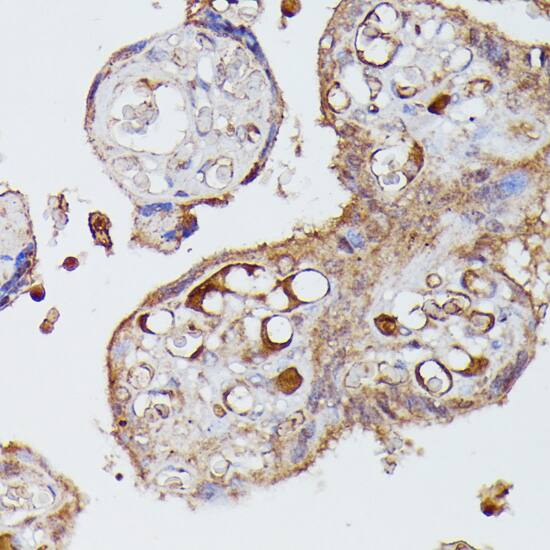 Immunohistochemistry: Serpin A8/Angiotensinogen Antibody [NBP3-35581] - Immunohistochemistry analysis of paraffin-embedded Human placenta using Serpin A8/Angiotensinogen Rabbit pAb at dilution of 1:100 (40x lens). Microwave antigen retrieval performed with 0.01M PBS Buffer (pH 7.2) prior to IHC staining.