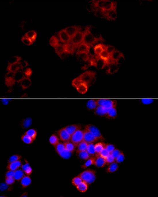 Immunocytochemistry/ Immunofluorescence: Serpin A8/Angiotensinogen Antibody [NBP3-35581] - Immunofluorescence analysis of HepG2 cells using Serpin A8/Angiotensinogen Rabbit pAb at dilution of 1:200 (40x lens). Secondary antibody: Cy3-conjugated Goat anti-Rabbit IgG (H+L) at 1:500 dilution. Blue: DAPI for nuclear staining.