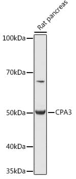 Western Blot: CPA3 Antibody [NBP3-35582] - Western blot analysis of lysates from Rat pancreas, using CPA3 Rabbit pAb at 1:1000 dilution.Secondary antibody: HRP-conjugated Goat anti-Rabbit IgG (H+L) at 1:10000 dilution.Lysates/proteins: 25ug per lane.Blocking buffer: 3% nonfat dry milk in TBST.Detection: ECL Basic Kit.Exposure time: 1s.