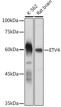 Western Blot: Pea3 Antibody [NBP3-35583] - Western blot analysis of various lysates using Pea3 Rabbit pAb at 1:1000 dilution.Secondary antibody: HRP-conjugated Goat anti-Rabbit IgG (H+L) at 1:10000 dilution.Lysates/proteins: 25ug per lane.Blocking buffer: 3% nonfat dry milk in TBST.Detection: ECL Basic Kit.Exposure time: 30s.