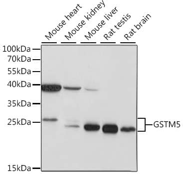 Western Blot: Glutathione S-transferase Mu 5 Antibody [NBP3-35584] - Western blot analysis of various lysates using Glutathione S-transferase Mu 5 Rabbit pAb at 1:1000 dilution.Secondary antibody: HRP-conjugated Goat anti-Rabbit IgG (H+L) at 1:10000 dilution.Lysates/proteins: 25ug per lane.Blocking buffer: 3% nonfat dry milk in TBST.Detection: ECL Basic Kit.Exposure time: 3s.