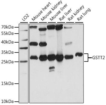 Western Blot: GSTT2 Antibody [NBP3-35585] - Western blot analysis of various lysates using GSTT2 Rabbit pAb at 1:1000 dilution.Secondary antibody: HRP-conjugated Goat anti-Rabbit IgG (H+L) at 1:10000 dilution.Lysates/proteins: 25ug per lane.Blocking buffer: 3% nonfat dry milk in TBST.Detection: ECL Basic Kit.Exposure time: 5s.