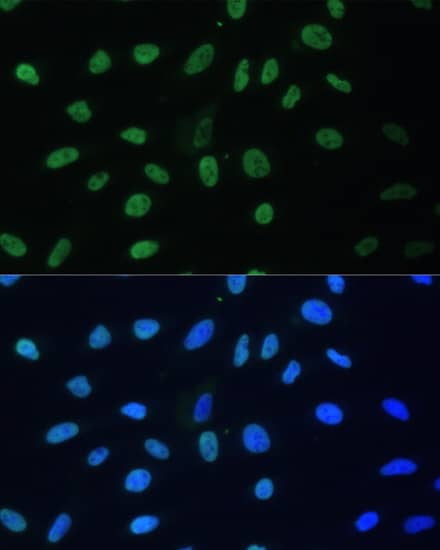 Immunocytochemistry/ Immunofluorescence: AUF1 Antibody [NBP3-35586] - Immunofluorescence analysis of U-2 OS cells using AUF1 Rabbit pAb at dilution of 1:100. Secondary antibody: Cy3-conjugated Goat anti-Rabbit IgG (H+L) at 1:500 dilution. Blue: DAPI for nuclear staining.