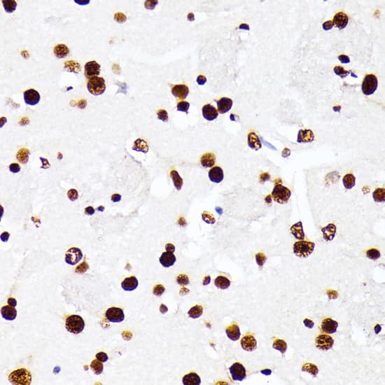 Immunohistochemistry: AUF1 Antibody [NBP3-35586] - Immunohistochemistry analysis of paraffin-embedded Mouse brain using AUF1 Rabbit pAb at dilution of 1:100 (40x lens). Microwave antigen retrieval performed with 0.01M PBS Buffer (pH 7.2) prior to IHC staining.